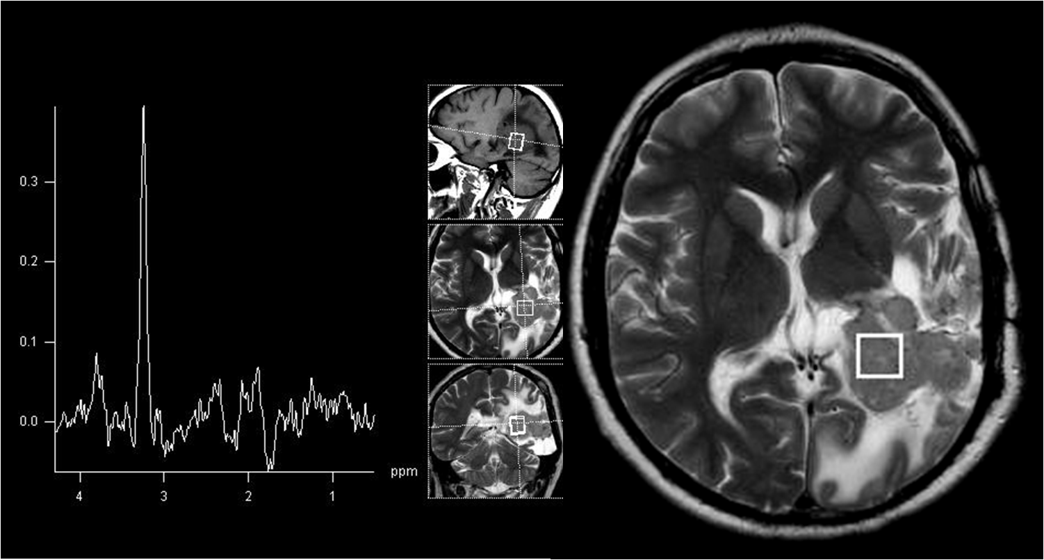 Képalkotó diagnosztika